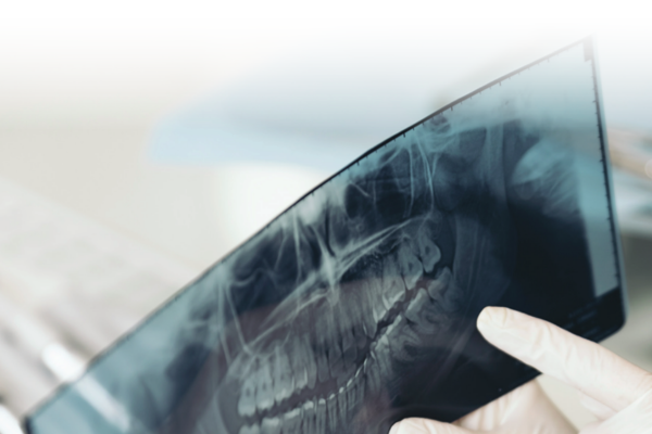 xray scan